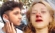 Bunları yapan çocuk Yüzüne kaldırım taşı attılar, kulağını yardılar