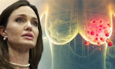 Angelina Jolie ile bilinirliği artmıştı: Kanser döngüsünü ‘dokuları aldırarak’ kırmak mümkün mü