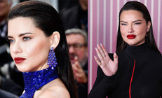 Ünlü modeli gören tanımakta zorlandı… ‘Senin güzel yüzüne ne oldu böyle’