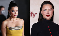 Estetik yaptırdığını söyleyenlere ateş püskürdü: Bu sadece yorgun bir annenin yüzü