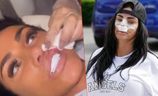 Estetik bağımlısı ünlü isim kendini durduramıyor... Bu uğurda iflas etti ama yine doktorun yolunu tuttu