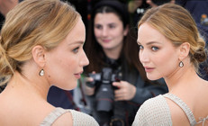 Ünlü yıldız estetik iddialarını reddetti... Benim bıçak altına yatmaktan ödüm kopar