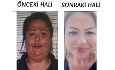 Bu da kardeş yüzlü dolandırıcı: Yaptığı estetik şoke etti