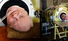 72 yılını metal kapsül içinde geçirdi Polio Paul hayatını kaybetti