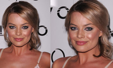 Bebek yüzlü yıldızı mercek altına aldılar: Yaptırdığı estetikleri tek tek saydılar