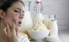 Süt ürünleri sivilce yapar mı Sivilcelerinizin sorumlusu tükettiğiniz süt ürünleri olabilir mi Araştırmalar ne diyor