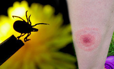 ‘Büyük taklitçi’ olarak bilinen hastalıkta umut veren gelişme İnsan terinde bulunan protein sonu olabilir… ‘Krem, ilaç ya da aşı üretilebilir’