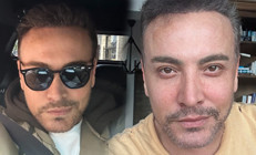 Estetik operasyonunun ardından Cenk Erene nazar değdi