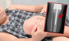 Aman dikkat Bu hastalık klasik büyüme ağrısı ile karıştırılıyor...