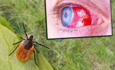 Burun ve gözlerde ölümcül kanamaya neden olan bu virüs can alıyor