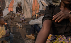 M çiçeği virüsü yayılıyor... Avrupadan sonra Asyadan da ilk vaka haberi geldi...