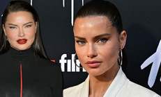 Yüzü tanınmayacak hale gelmişti… Ünlü modeli gören şaşkına döndü: Eski Adriana’mız geri dönmüş