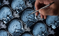 12 yaşındaki kıza tümör teşhisi konuldu: İlk işareti gözlerinde görüldü