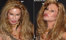 ‘Kedi kadın’ şaşırttı: Hiç estetik yaptırmadım