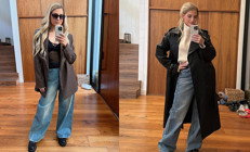 Estetik tutkusu kötü bitti: Artık gülemiyorum bile...