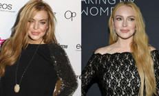 Estetik iddialarıyla gündemdeydi… Ünlü doktoruyla poz verdi