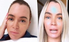 Ünlü oyuncu defalarca ameliyat oldu, bir türlü iyileşemedi… Kanser akciğerine sıçradı… Üç çocuğu için umutla savaşıyor