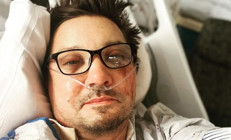 Ünlü oyuncu ölümden dönmüştü: Bütün kemiklerimin çatırdadığını duydum... Sağ gözümle sol gözümü görebiliyordum