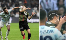 Beşiktaşta sakatlıklar tat kaçırdı Yıldız oyuncunun dişi kırıldı