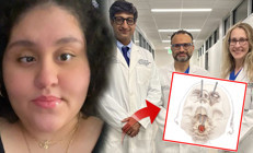 Tıp dünyası için yeni bir sayfa: Hastanın gözünden omurga kanseri tümörünü çıkardılar