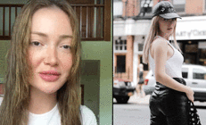 Kalça dolgusu kaburgasına çıktı... Danla Biliç doktorunu suçladı