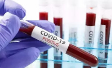 ABDde COVID-19 ölümleri arttı: Her hafta 300 kişi hayatını kaybediyor