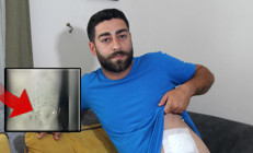 Karnında hissettiği ağrıyla hastaneye gitti, gerçek çekilen röntgenle ortaya çıktı