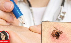 10 maddede kene hakkında doğru bilinen yanlışlar