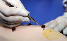 Lyme hastalığı hakkında şaşırtan iddia ‘ABD’nin biyolojik silahı mı’