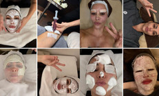 Enjeksiyonlar, maskeler, yüz bantları… Güzellik uğruna okyanusları aştı: Özel jetle Kore gezisi