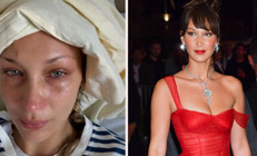 Güzelliği ve milyonları olsa neye yarar... Sağlığı çoktan gitti... Bir hastane odasında çaresiz hastalığıyla baş başa