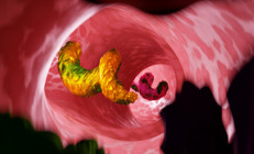 Hızla yayılıyor Kendi kendine iyileşir mi Sonbahar bu hastalıklar ile geliyor