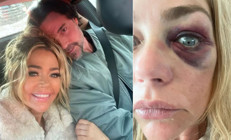 Ayrıldığı kocasından gördüğü şiddeti gözyaşlarıyla anlattı… ‘Beni hayat kadınlarıyla aldatan eşim hiç senin kadar alçalmadı’