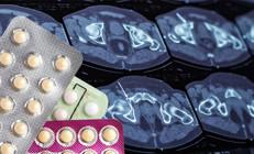 İki milyondan fazla kadın incelendi, sonuçlar oldukça endişe verici Doğum kontrol hapları o korkunç hastalığa neden oluyor olabilir