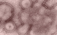 ABDde H3N2 virüsü endişesi: Farklı ülkelerde de görüldü Salgın şiddetli olabilir