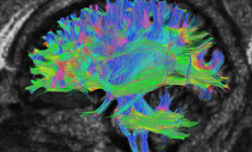 Bu araştırma yaşla ilgili bildiğimiz her şeyi yerle bir etti 32 yaşında ergenlikten çıkıyor, 66’da ise yaşlanmaya başlıyormuşuz
