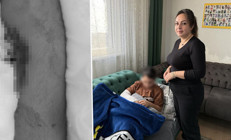 Okulda akran zorbalığı: 9 yaşındaki çocuk arkadaşının kolunu iki yerinden kırdı Öğretmene şikayet ettiği için intikamını aldım