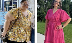 Ortaya çıkan sonuç inanılmaz: İğne ile kilo vermek mi, cerrahi müdahale mi Araştırma çarpıcı farkı ortaya koydu...