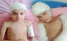 12 yaşındaki Tunahanın hayatını kabusa döndü Sokak köpeği saldırısında aileye 5 milyon lira tazminat ödenecek