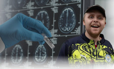 Demansı yaşlılık hastalığı olarak bilirdik… 24 yaşındaki genci nasıl hayattan kopardı