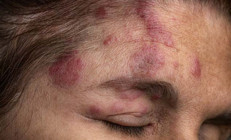 Uzmanlardan kritik uyarı: Vücudunuzdaki virüs her an uyanabilir