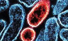 ‘Nipah pandemisi’ kapıda mı... 27 yıllık virüste salgın endişesi