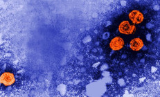 Bilim insanları, bakteri avcısı yapay virüs üretti