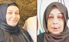 Tırnak makaslı işkenceye 15 yıl