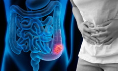 Bilim insanları yeni bir tedavi keşfetti Gençler arasında yayılmaya başlamıştı... O kanser tarih mi oluyor