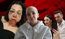 Küfretmeyin diyen anne ve oğlunu öldüresiye darbetmişlerdi Yaşadığı dehşeti anlattı