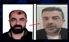 Ankarada akıllara durgunluk veren olay: Ameliyatla yüzünü değiştirdi, kardeşinin kimliğiyle ülkeye giriş yaptı Yakalı ele verdi
