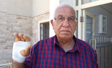 Asansördeki sorudan sonra saldırdı: Gözü dönmüş adam komşusunun parmağını ısırıp kopardı