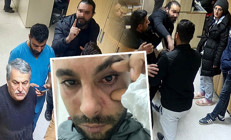 Doktordan hastaya yumruklu saldırı iddiası: Yüzde 30 görme kaybı oluştu | Düşmanına vurur gibi yumruk atıyor