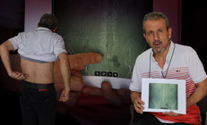 Ameliyatta akılalmaz hata Doktor önce inanmadı, sonra kabul etti... Mağdur adam çare arıyor: Riski göze almıyorlar